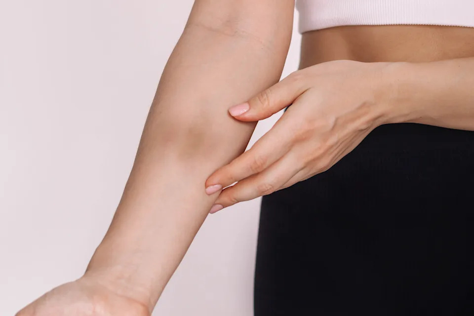 Primer plano de una mujer extendiendo su brazo herido
